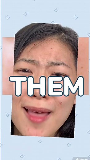 How to Get Rid of Papules | FaceTory