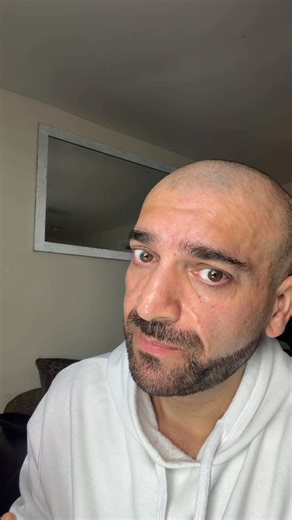 Been testing the new AprilSkin Pink Aloe Mucin Serum for about a week — and I’m actually impressed 👀💧 It’s made with 78% pink aloe, 2% niacinamide, panthenol, and Vita-7 complex — and my skin loves it so far. It feels super light, non-sticky, doesn’t clog pores, and keeps my skin hydrated all day 💦 Pink aloe helps soothe and calm irritation, niacinamide brightens and evens the skin tone, panthenol strengthens the barrier, and Vita-7 gives that healthy glow 🌸✨ #AprilSkin #KBeautySkincare #Glo