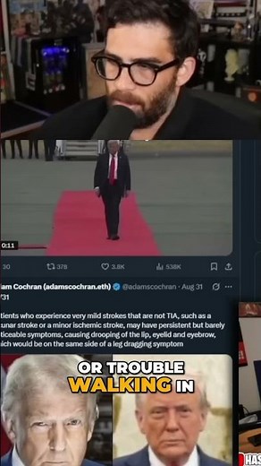 TIA Symptoms: What Happens After a Transient Ischemic Attack? #shorts