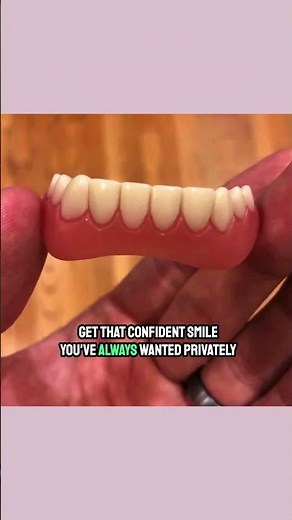 Instant Smile Teeth Veneers | Upper and Lower Teeth | Fix Your Smile at Home Within Minutes!