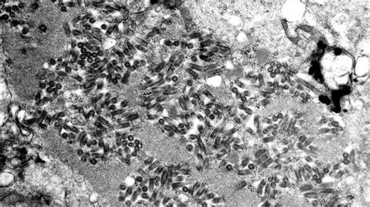 After 5 rabies deaths in 2021, CDC says some of those lives could've been saved