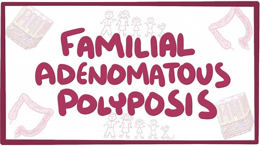 Familial adenomatous polyposis: Video, Causes, & Meaning | Osmosis