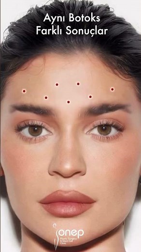 how to inject botox .... botox injection guide