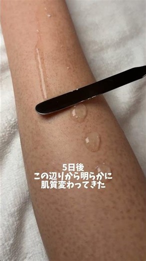 ダイソーのブラシで腕ダニケアしていく！！#pr#美容#スキンケア#美容液#韓国コスメ#ピュネラ