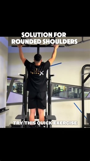 Transform your posture 👇 Get the full Hunchback Fix Guide in bio