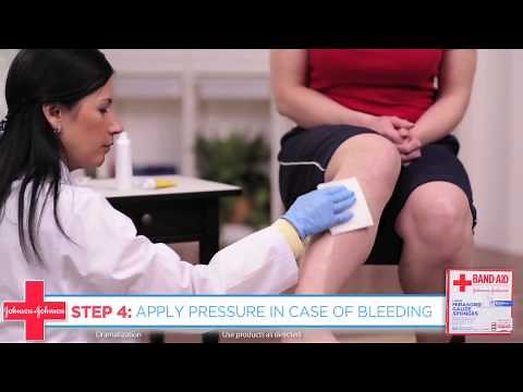 How to Clean a Wound Post-Surgery - Band-Aid® Brand of First Aid Products