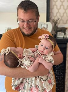 “Born as one… but now living as two” 💕✨ These miracle twins defied the odds after a rare surgery — and their story still feels unreal. See the powerful photos in the comments below 👇📸 | Stories of the Day