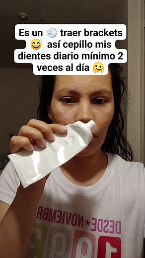 Todo sea para tener Dientes Bonitos 😍🥰 #brackets #cepillado #fypシ゚ | Araceli Rodriguez