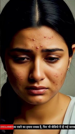 PCOD Diet Plan | Foods To Avoid If You Have PCOD | Foods to Eat vs. Foods to Avoid In PCOD