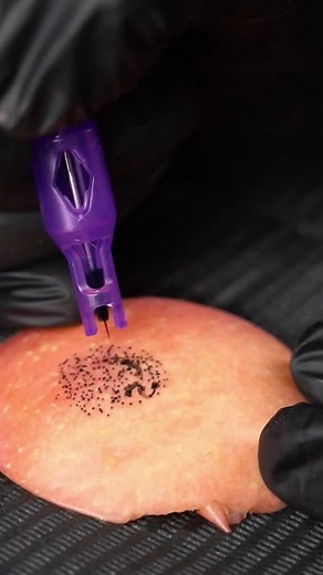 Mast Max SMP: The Miracle of Hair Follicle Replication