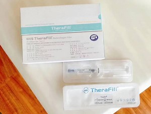 [Hot Item] Therafill Filler Is a Sterile Highly Purified Collagen Fill Depression for Facial