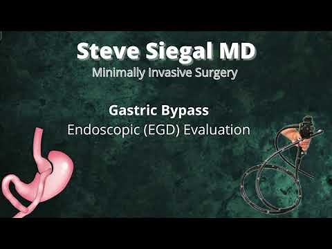 Gastric Bypass Endoscopy (EGD)