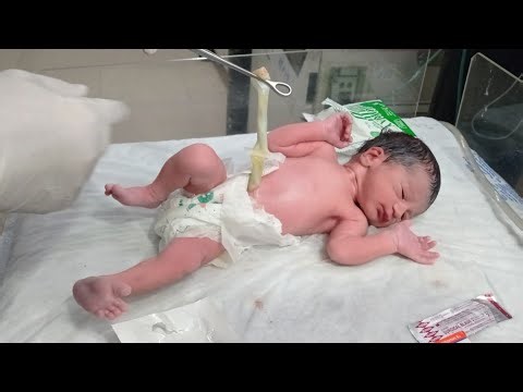 Newborn Baby Care | Vitamin K Oral Dose, largest Umbilical Cord Care, Physiotherapy & Warmer Care