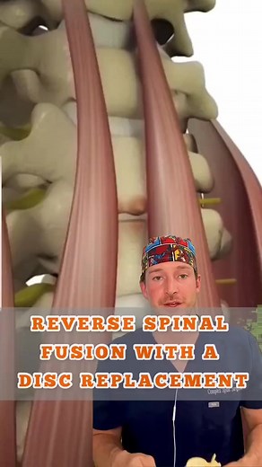 #spine #expert #anatomy #fracture #medical #healthcare #Dallas #Friscotx #telemedicine #nurse #herniation #neurosurgery #orthopedics #orthopedicsurgery #ORnurse #xraytech #medicalStudent #pain #DiscReplacement #spineSurgery #acdf #radiculopathy #Spinedoctor #Internist #oklahoma #fusion #spondylolisthesis #lubbock #MRI #homedepot #mckinneytx | Donnallyspineconsult