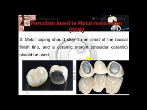 All-Ceramic Restoration