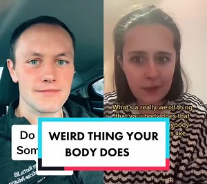 Understanding Ectrodactyly: Splitting Fingers Explained