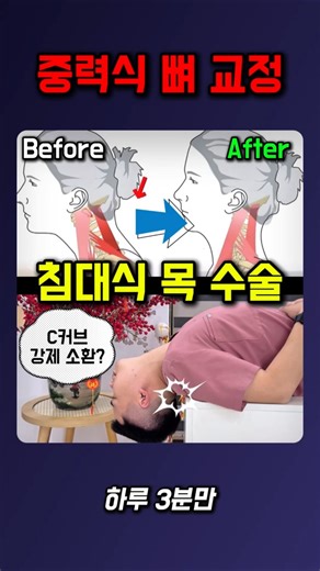 중력식 뼈 교정 #거북목 #일자목교정 #목디스크운동