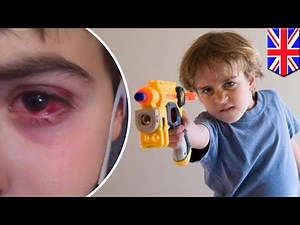 Nerf guns: Toy can cause eye swelling, bleeding when hit with foam bullets - TomoNews