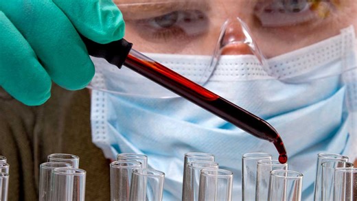 This Biotech Just Reversed An 89% Run. Is It An 'Overreaction?'