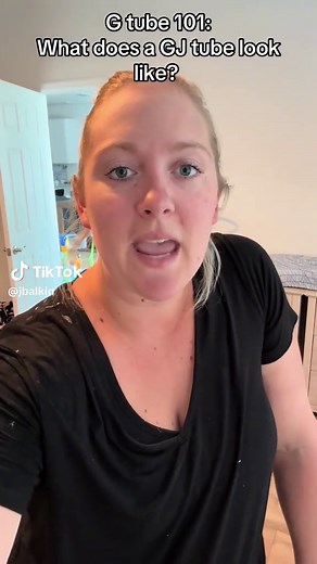 G Tube 101: Essential Guide for Parents of Tube-Feed Babies