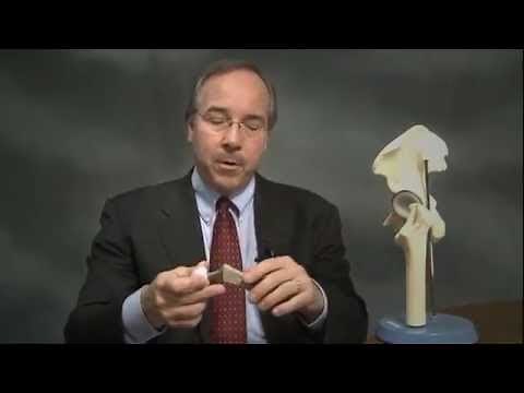 Hip Replacement Surgery | What to Expect