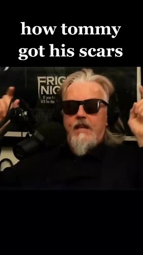 416K views · 3.8K reactions | how tommy Flanagan got his scars sons of anarchy sonsofanarchy tommyflanagan fyp soa555 | Charlie.Hunnammmmmmm | Facebook