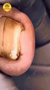 Ep.4882 Sodium-savvy, label-smart plans steady solo budget days 🤡😽 #SodiumAwareness #LabelSmart #SteadyClarity | LOS A-T BOYZ