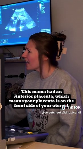 Anterior Placenta Babies: Snuggly & Sweet Post-Birth!