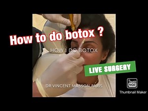 TECHNIQUE POUR INJECTIONS DE BOTOX. HOW DO DO BOTOX INJECTIONS.