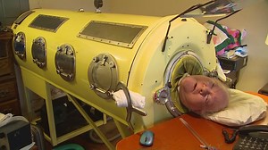 'I'm honored to have been his brother': Paul Alexander, oldest iron lung and polio survivor dies at 78