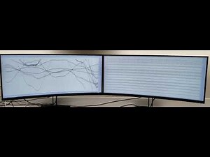 MEGIN's MaxFilter Software - MRI Interference