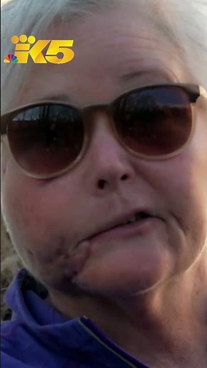 Survivor, friends who fought cougar describe cougar attack near Snoqualmie