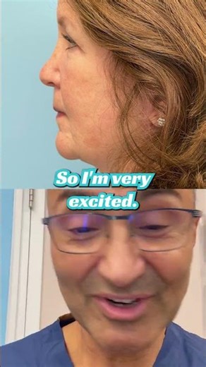 Can you even tell she had a FACELIFT just TWO YEARS AGO?