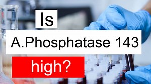 Is Alkaline phosphatase 143 high, normal or dangerous? What does ALP level 143 mean?