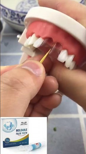 moldable false kit helps fix teeth & save money, can reuseable #dentist #dentalissue #teethwhitening