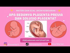 PLASENTA PREVIA| SOLUSIO PLASENTA( PERDARAHAN ANTERPARTUM) #ukombidan #solusioplasenta #bidan