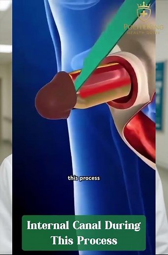 Understanding Male-to-Female Gender Confirmation Surgery: What It Really Means