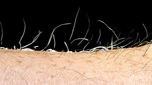 16K views · 224 reactions | Got goosebumps?  Human hair can stand up in response to fear, cold, or other strong emotions. Hairs stand when the tiny arrector pili muscle at the base of each hair strand contracts. | Science Channel | Facebook