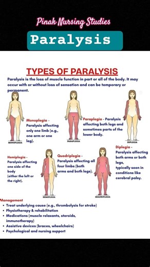 Paralysis