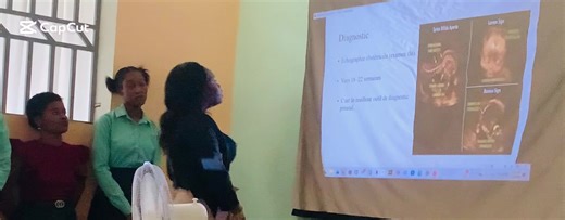 Nos etudiants et étudiantes en première année des Sciences infirmières Modernes exposent deja comme des Grand(e)s 😁 sujet: Spina Bifida et Anencéphalie , 2 pathologies courantes en Embryologie. VINI NAN ESSIM😁