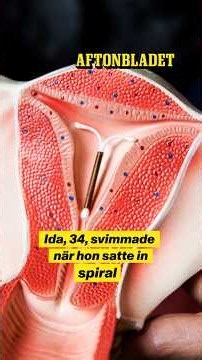 Ida, 34, svimmade när hon satte in spiral