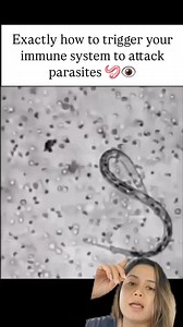 189K views · 3.8K reactions | EXACTLY HOW I ERADICATE BIOFILMS 缾 1....