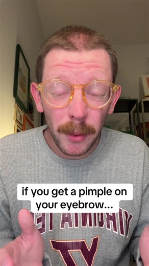 What to Do If You Get a Pimple on Your Eyebrow