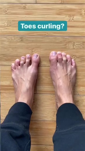 Toe Exercises for Healthy Feet: Fixing Crooked Toes at Home