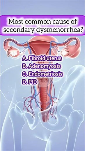 Female reproductive system mcqs part 17 #mcqs #femalereproductivesystem #quiz #humanbiology