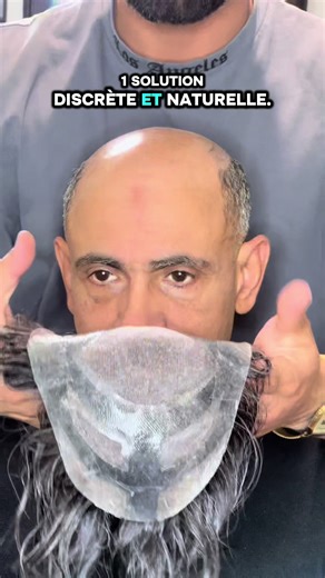 Perte de cheveux ? On a la Solution! Diagnostic personnalisé offert 📍 Paris 📲06.95.39.36.28 👉 Rdv en Message privé #calvitie #pertecheveux #complementcapillaire #paris #avantapres