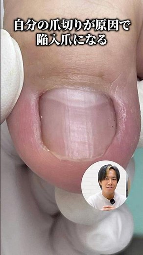 【注意】実は多くの人が爪の切り方を間違えています！正しい切り方はこれ！