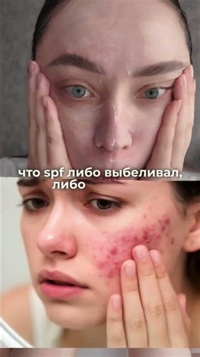 почему SPF выбеливает кожу и как выбрать правильный