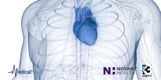 Understanding and treating atrial fibrillation (AFib)