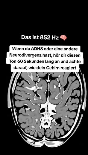 ADHS-Handbuch: 134 Strategien für ein besseres Leben